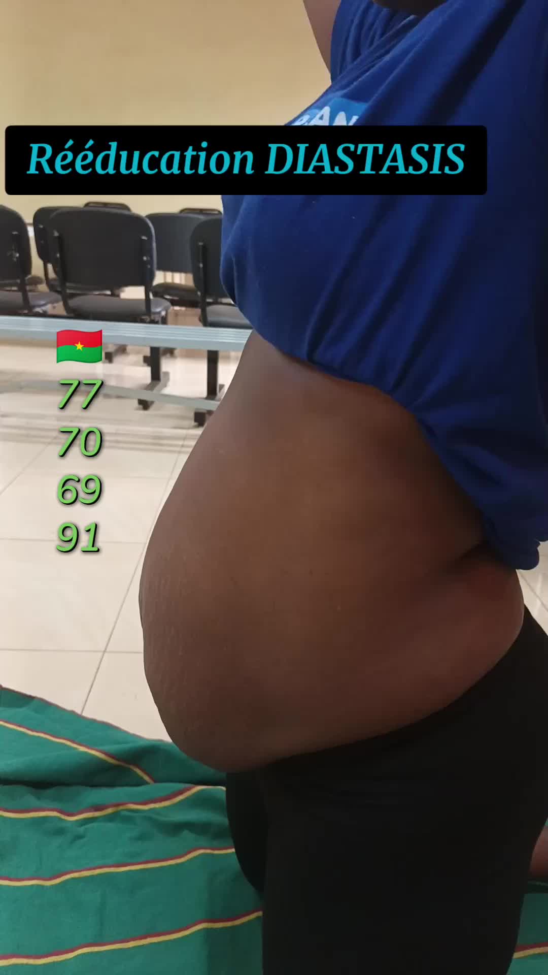 @DIASTASIS /Périnée