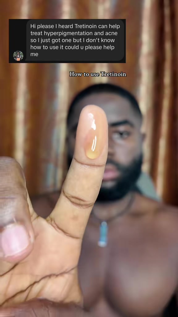 @Nana Adjei