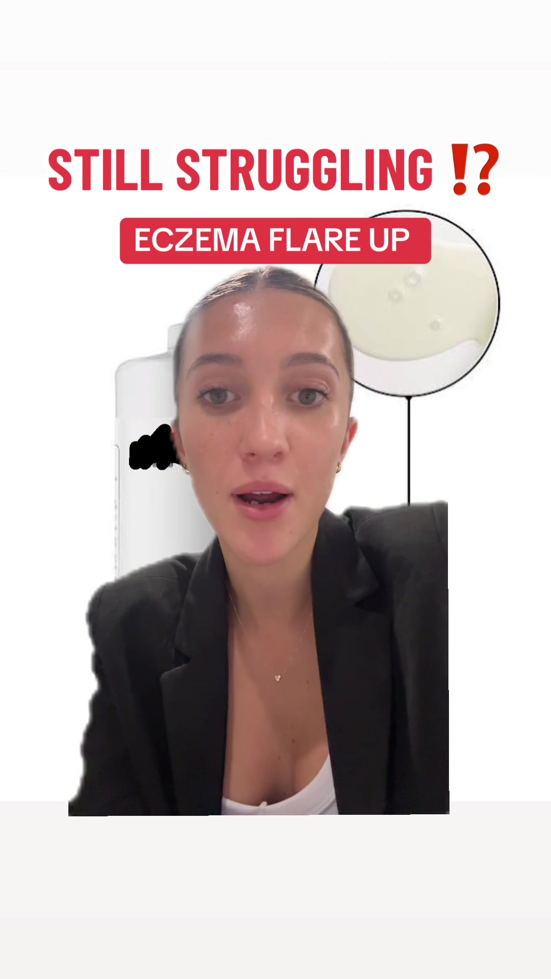 @Eczema Diaries USA & UK