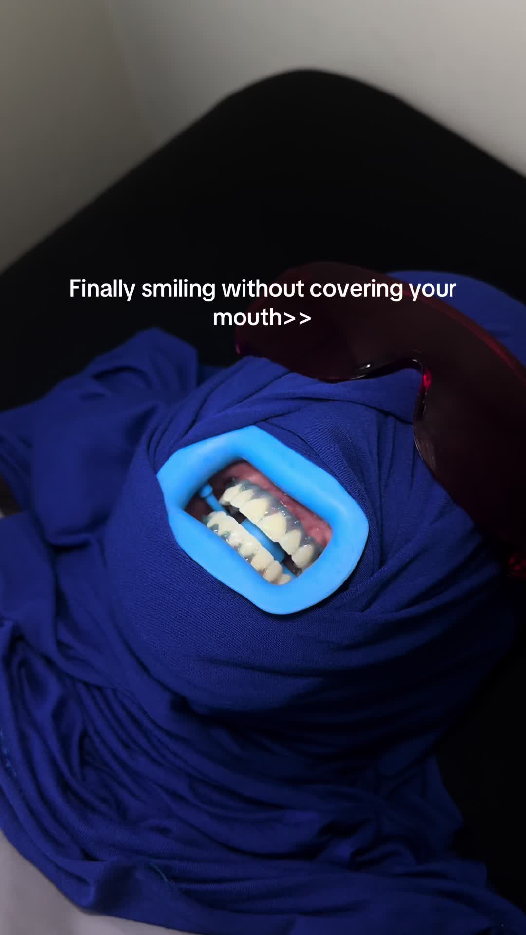 @Halal Teeth Whitening London