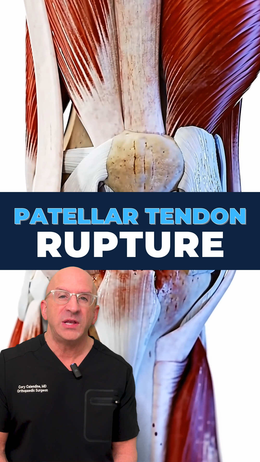 @Bone Doctor - Joint Pain MD