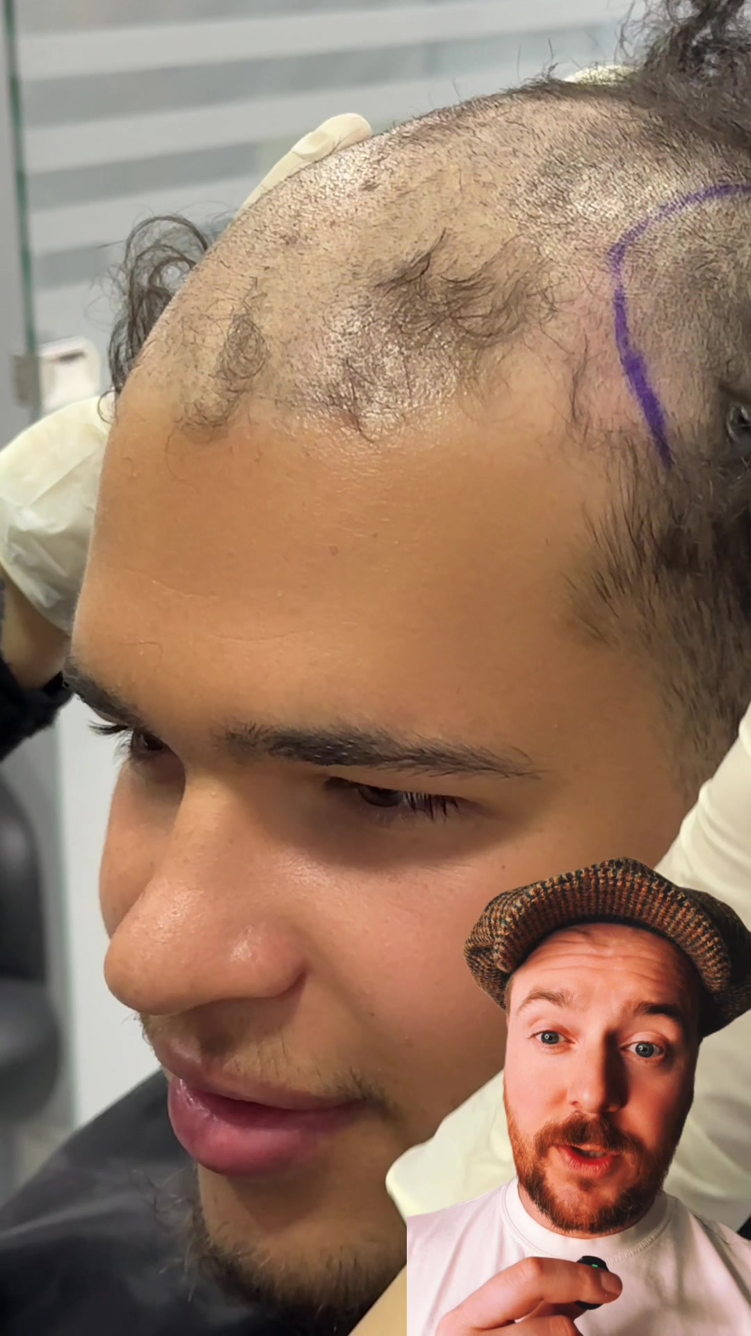 @RECOVRY Hair