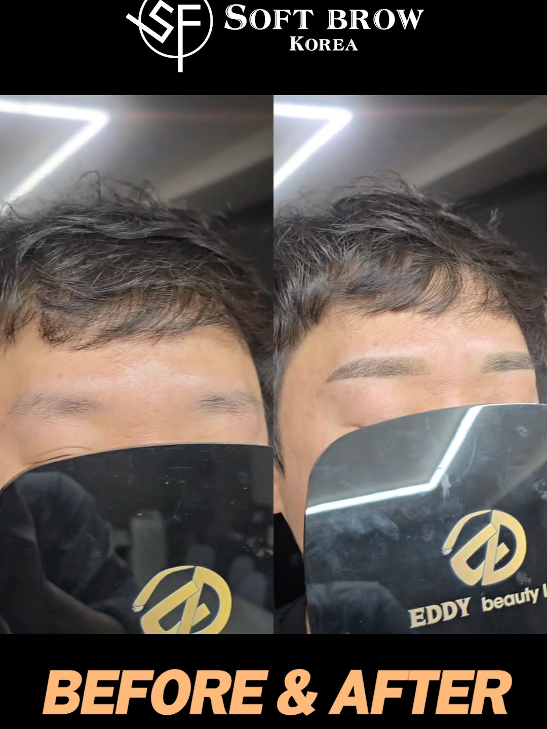 @EDDY BEAUTY KOREA