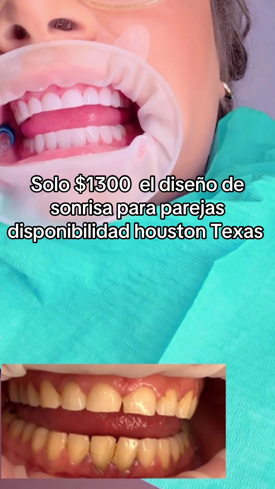 @Smilesdesigncaliope