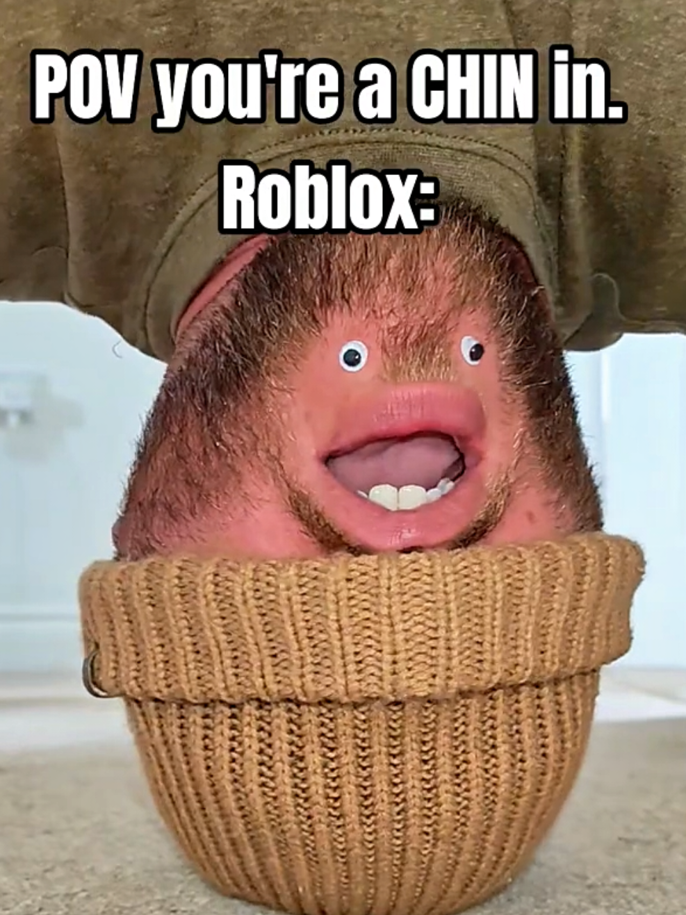 @Chinfaced