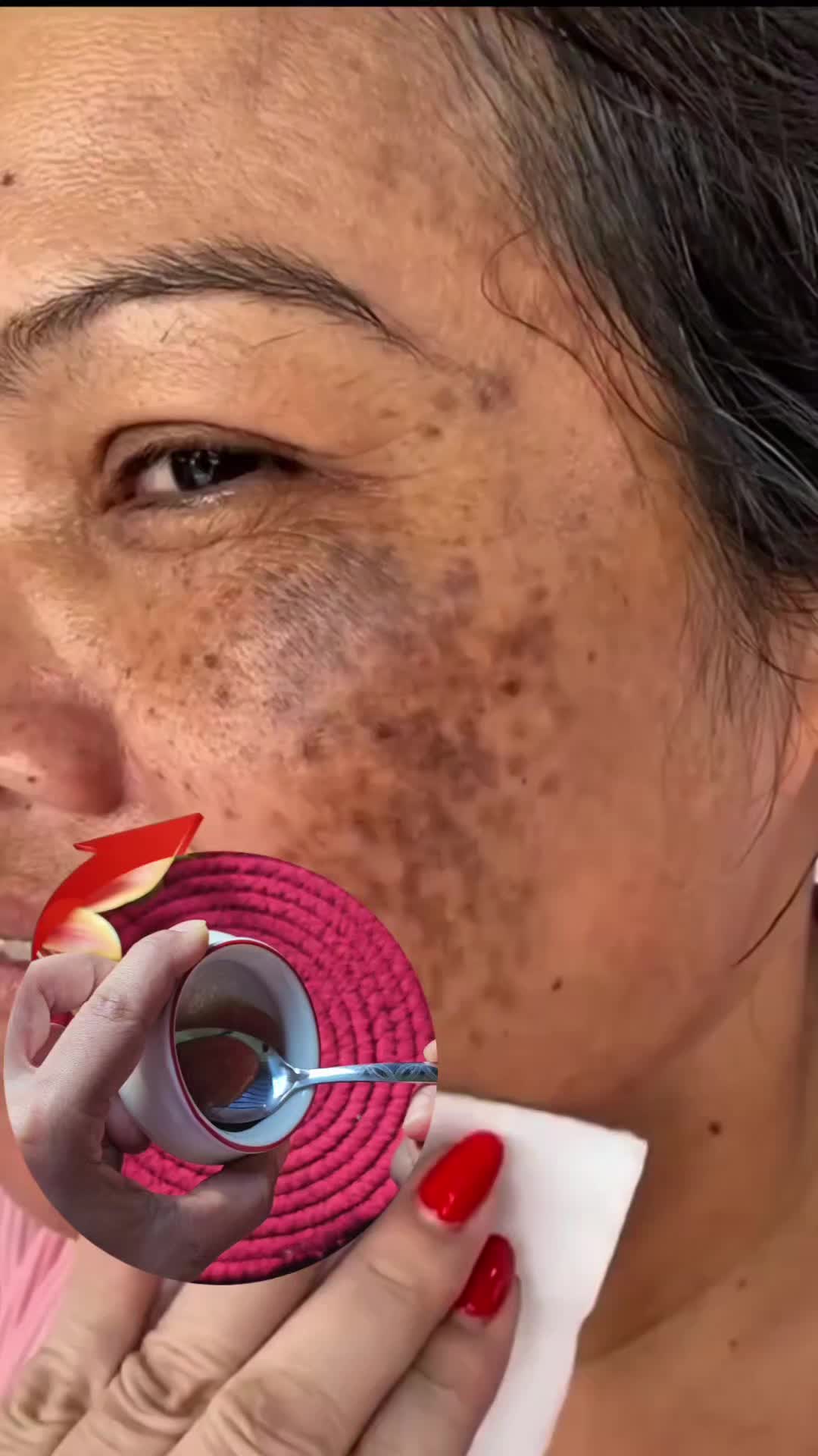 @Natural Beauty Remedy