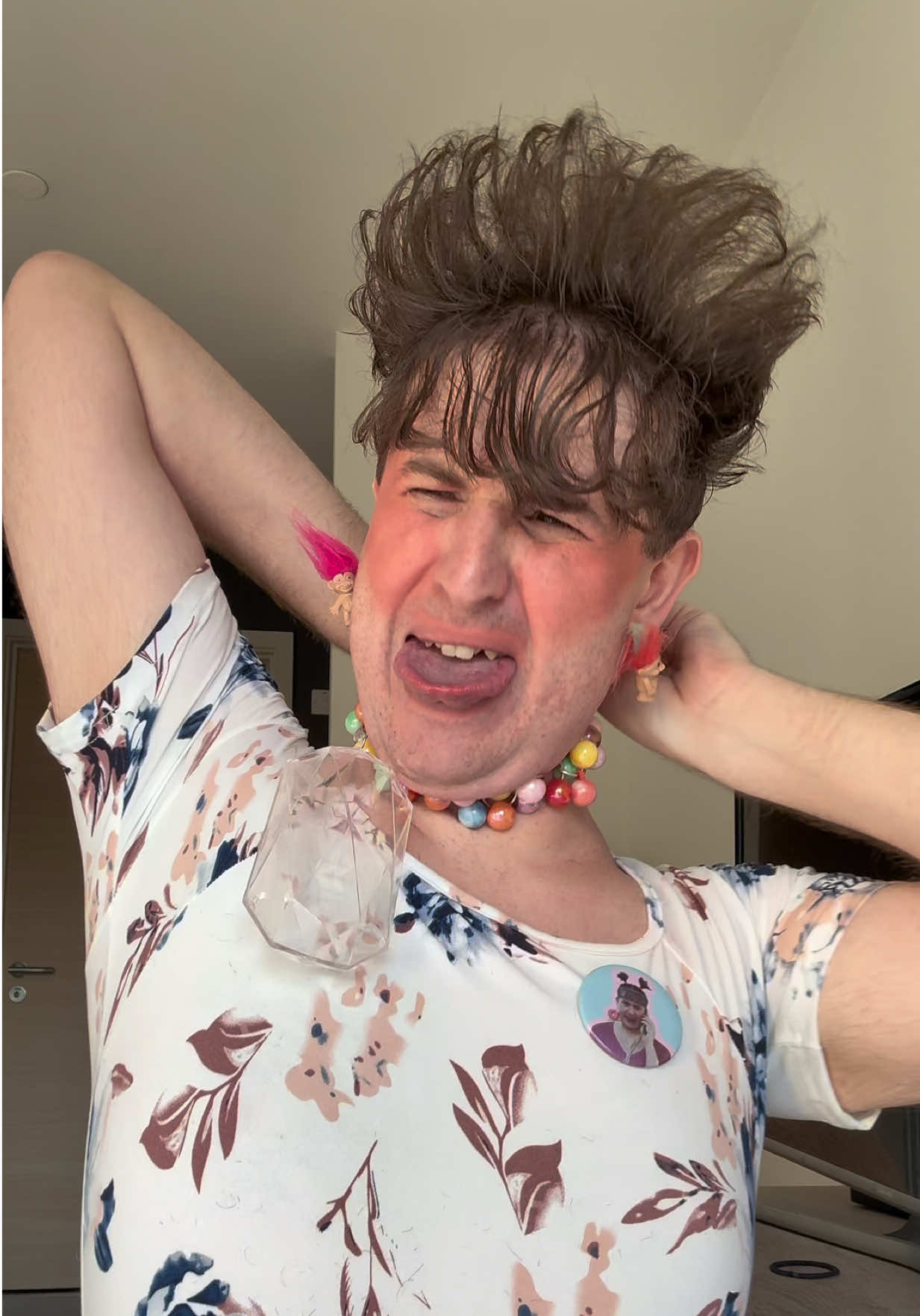@ANTONIO FEDEZ