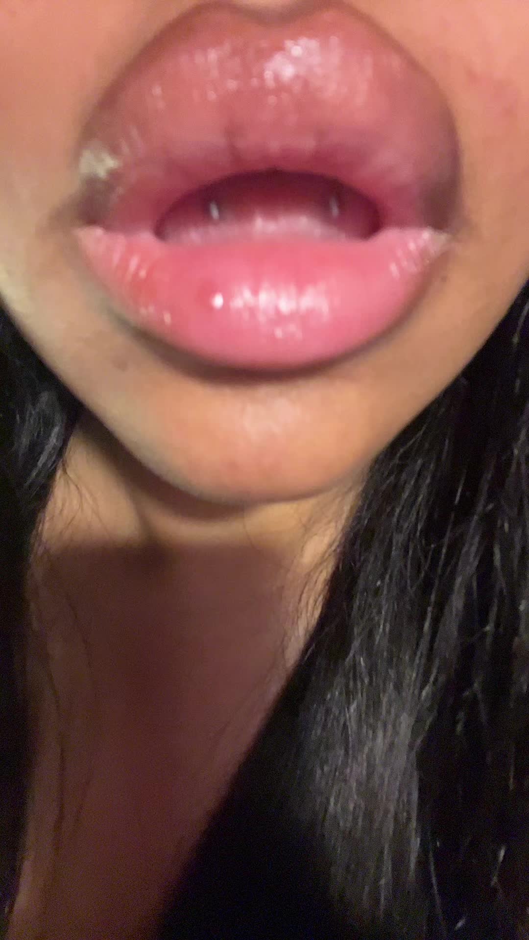 @Rhi
