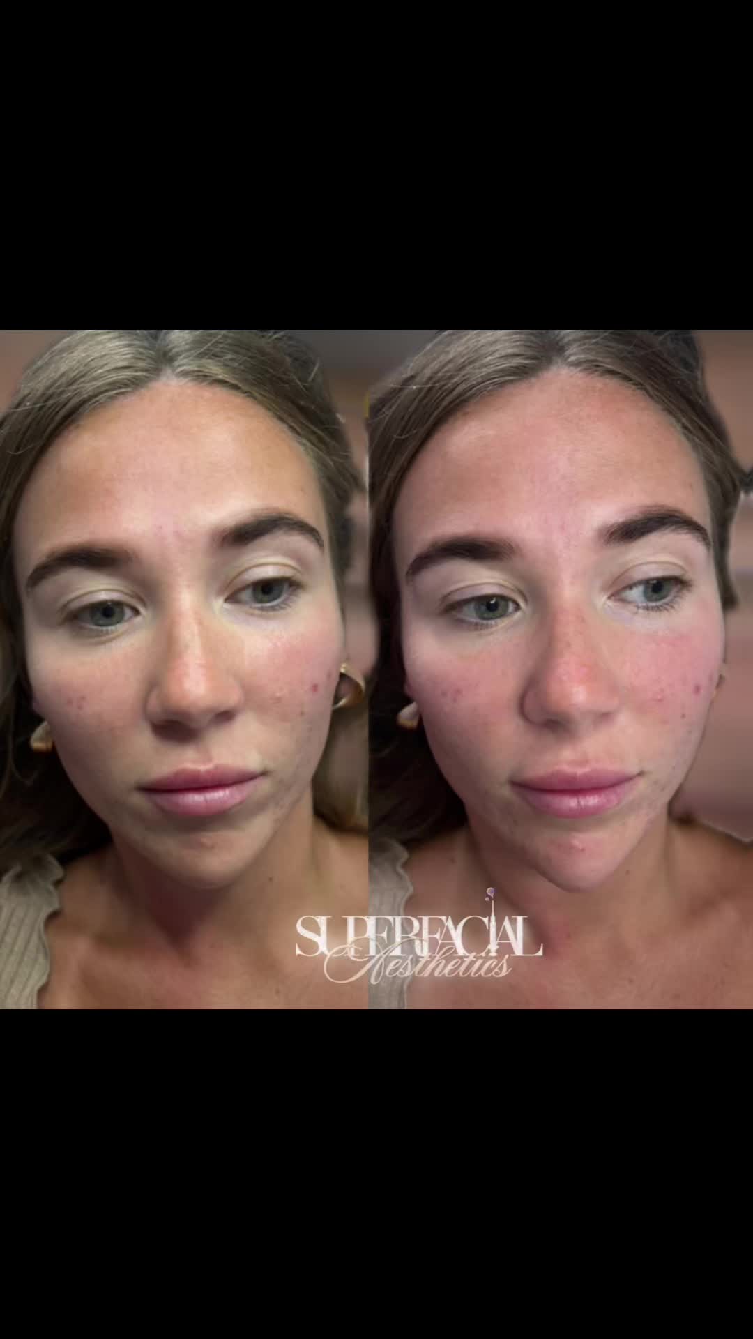 @Superfacial Aesthetics