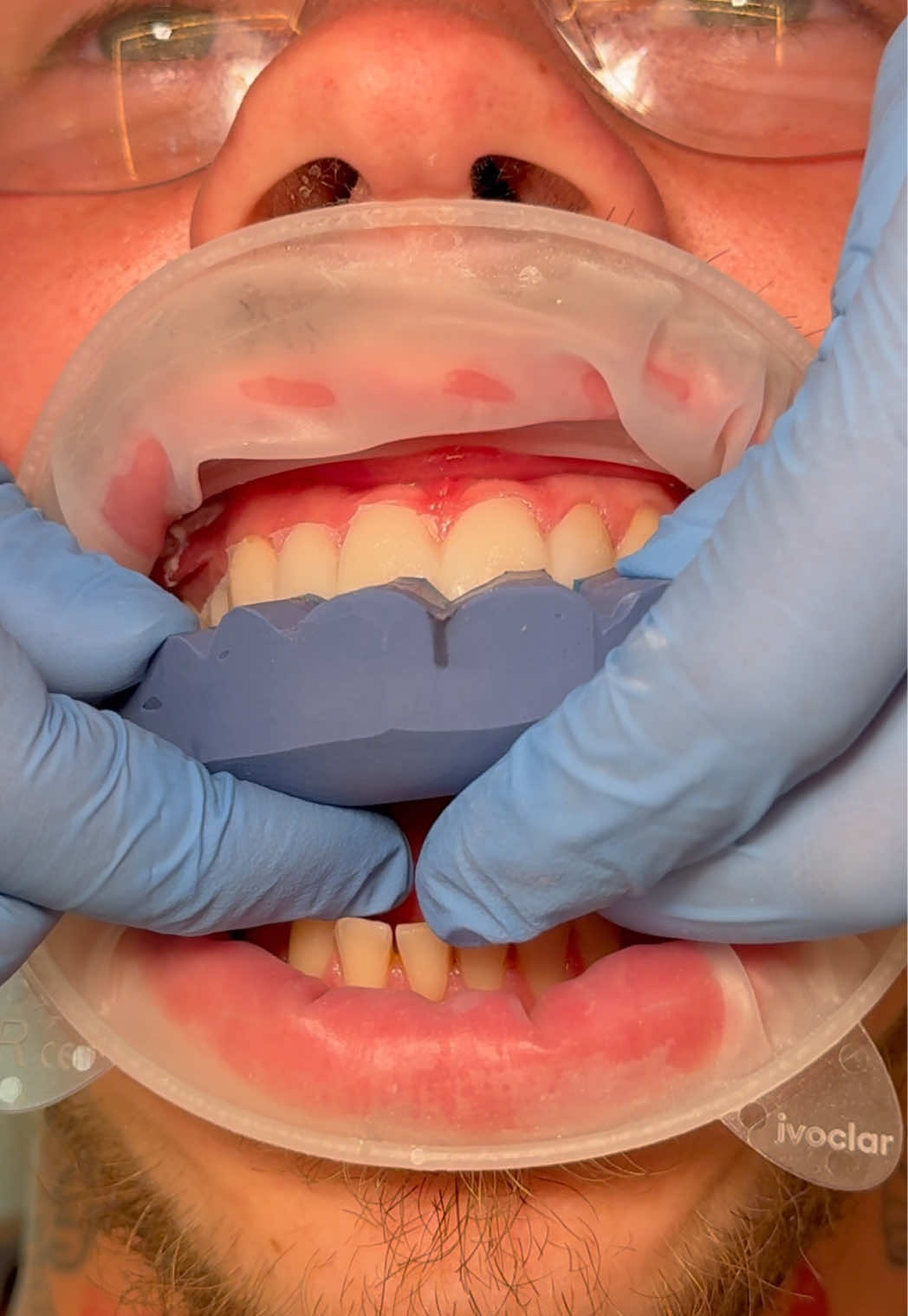 @Dentalexcellenceuk