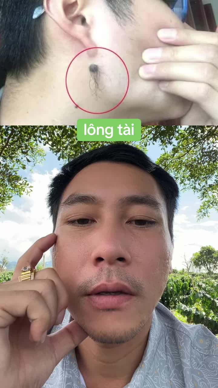@Tuệ Nhãn ✅