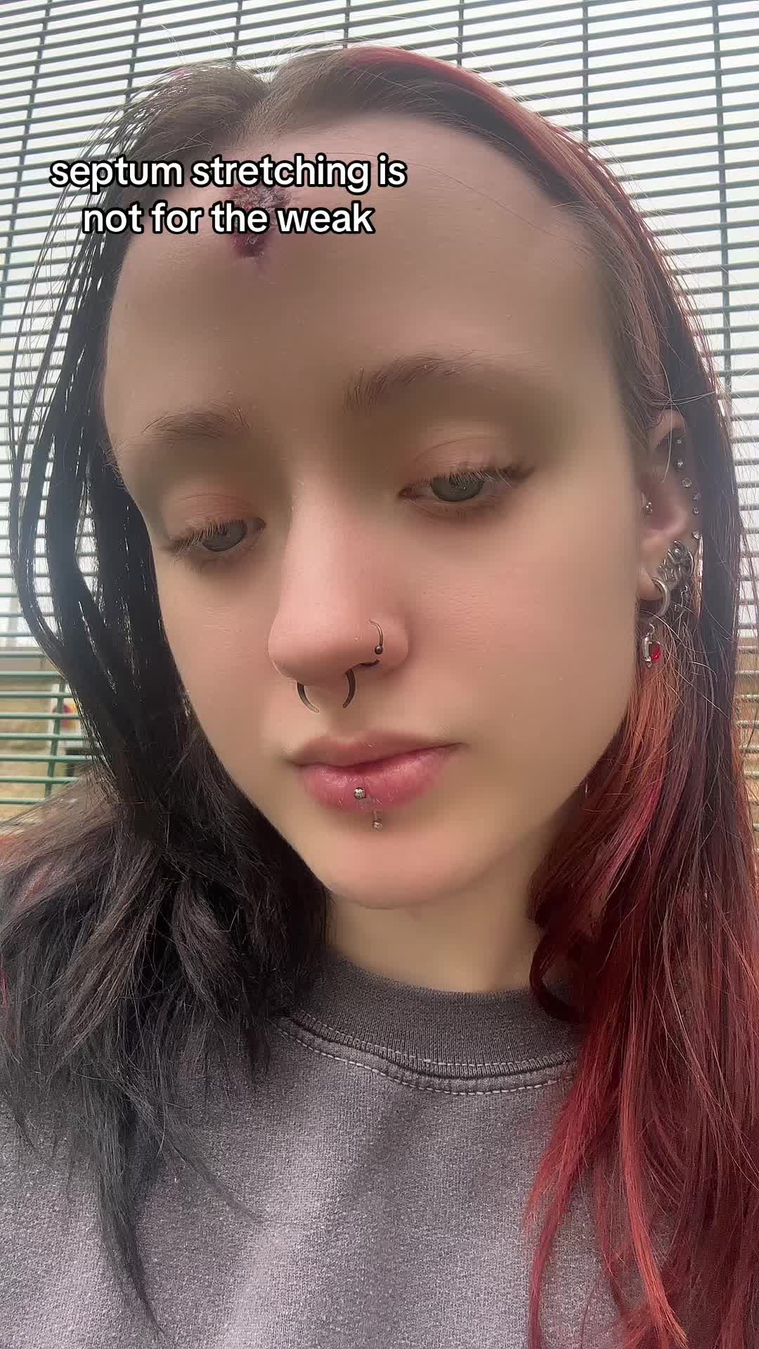 @katieseupdrecovery