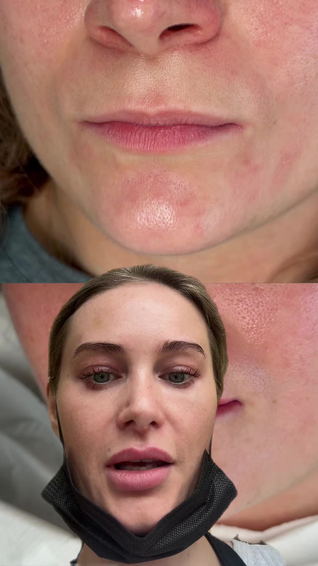 @Rebecca Teasdale | Lip Blush