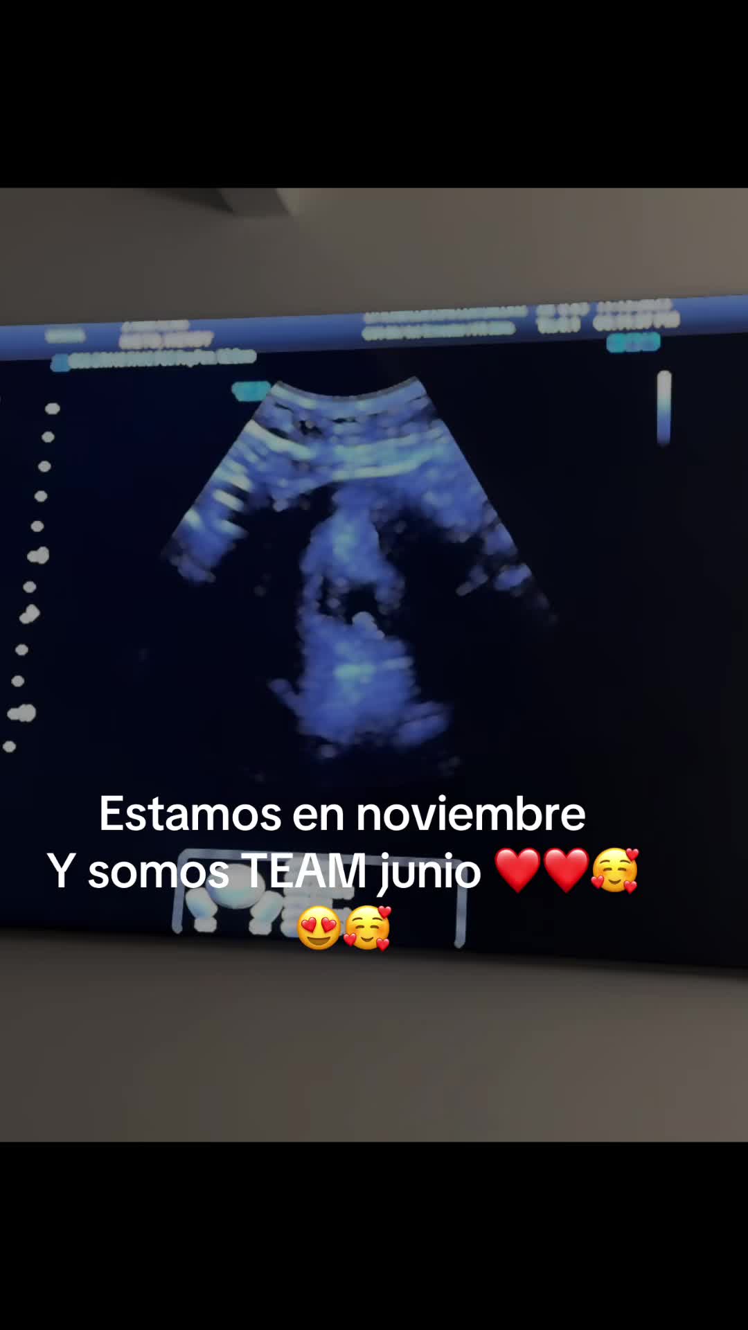 @Wendy❤️