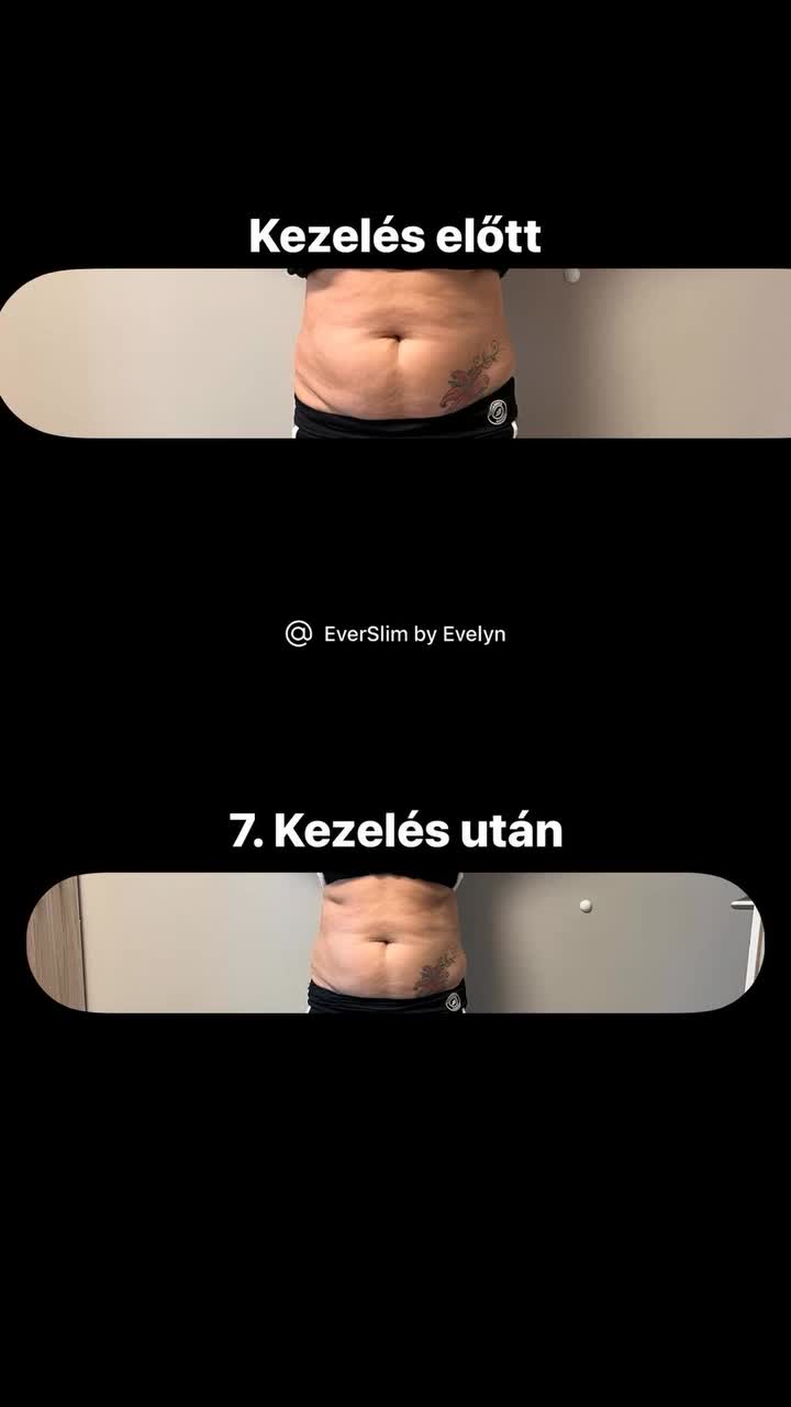 @EverSlim by Evelyn🌸