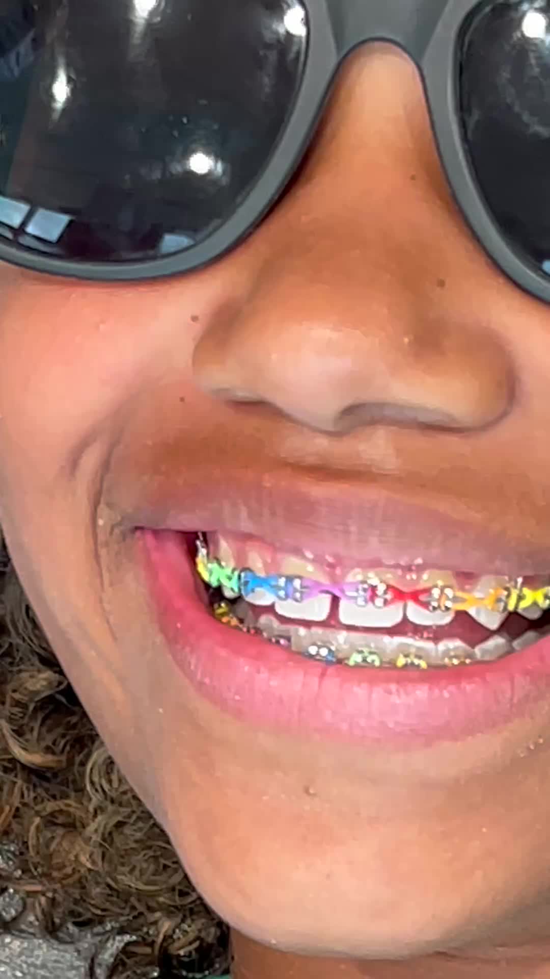 @The Braces Guy