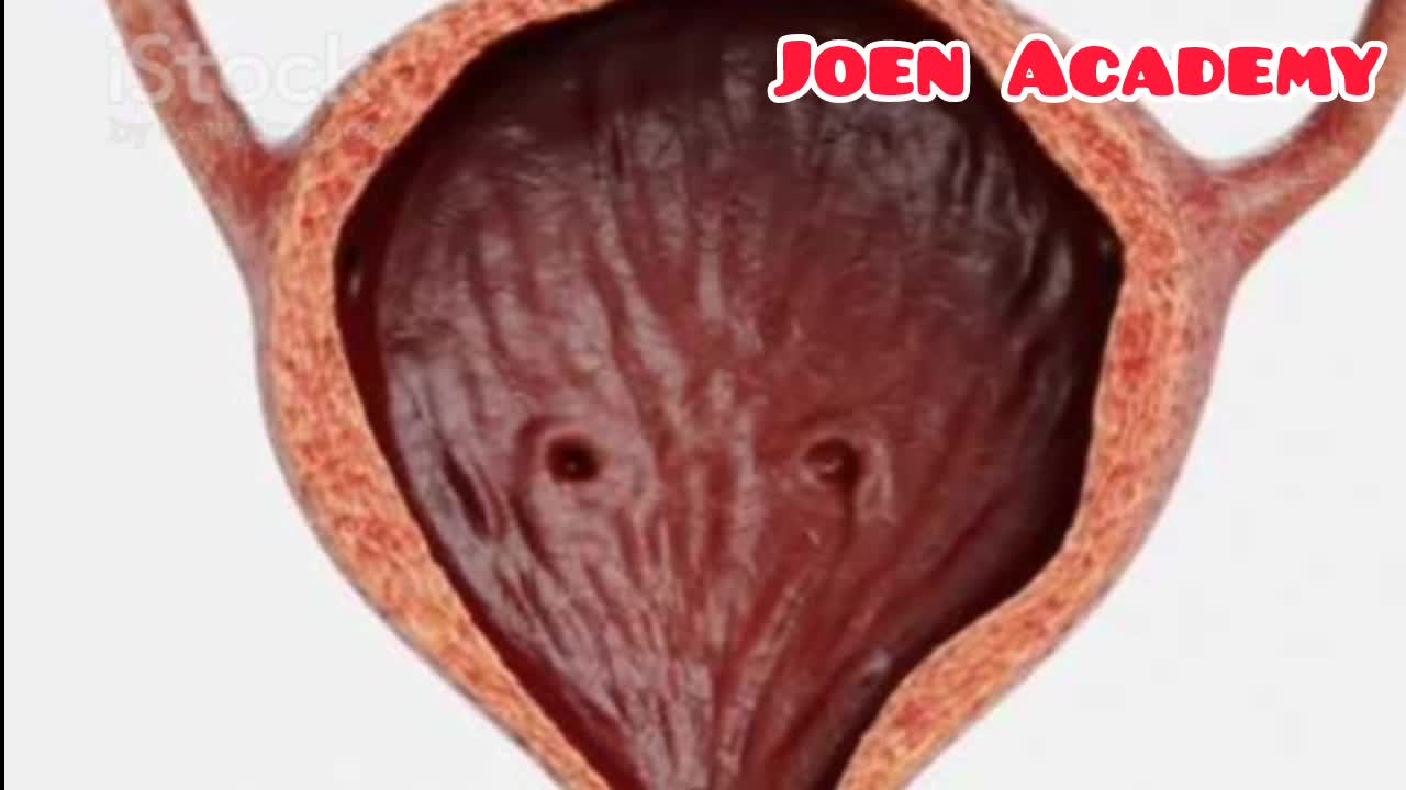 @Joen Academy