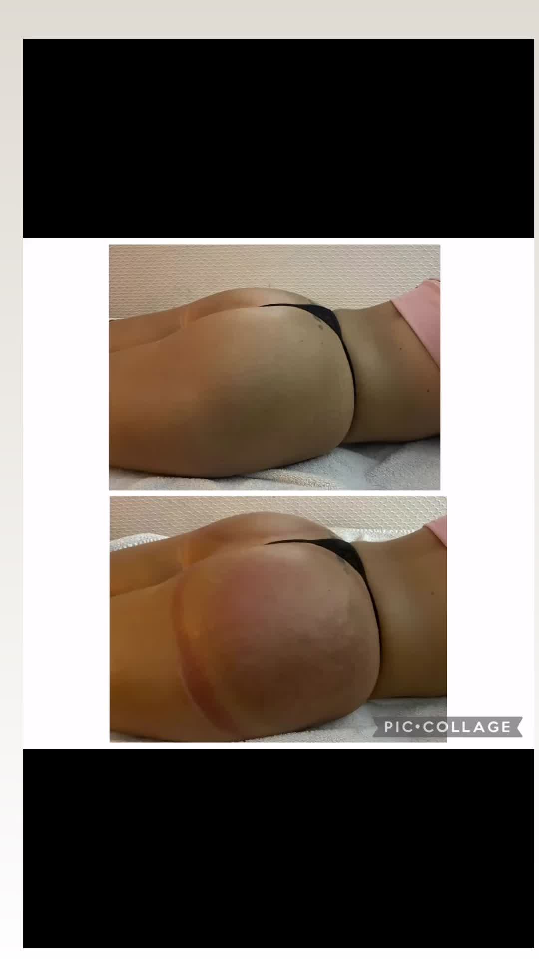 @XLbootybodysculpting