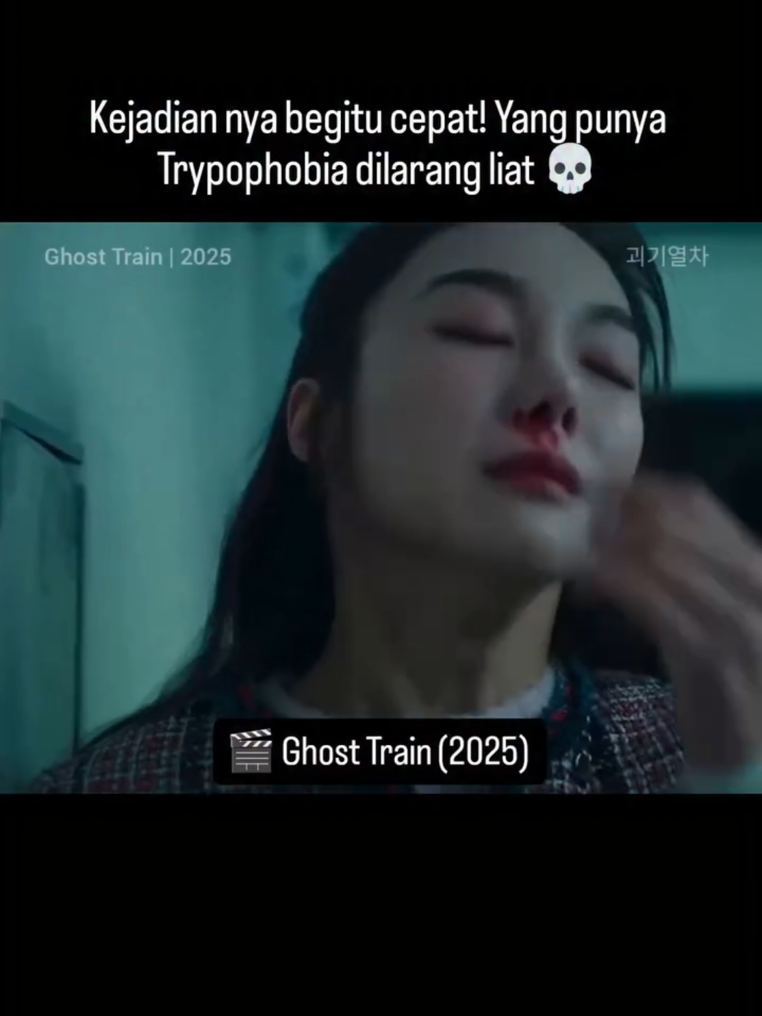 @LENS HG