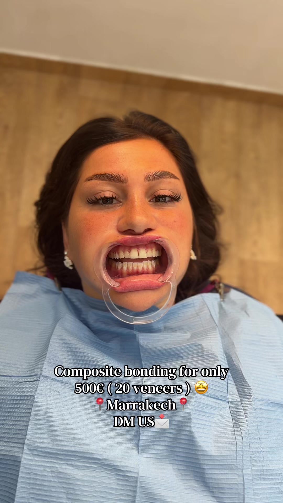 @Smilesecret