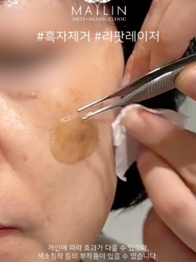 @메이린의원대구점