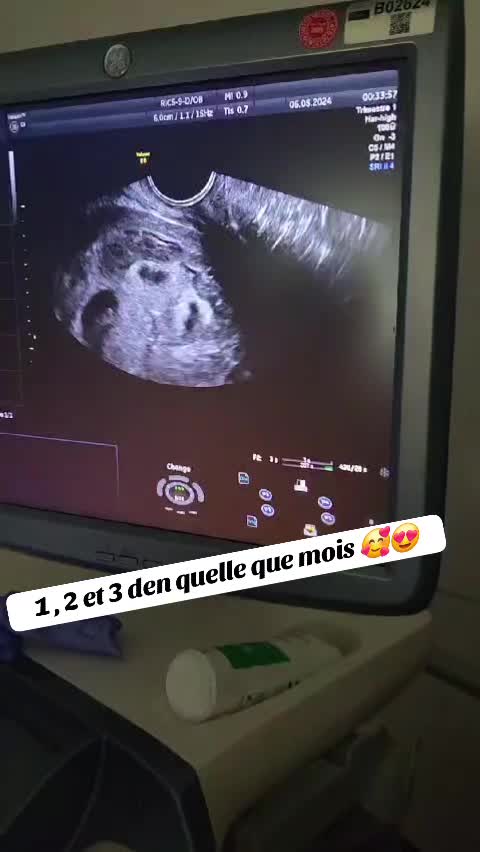 @mom's triplet+2