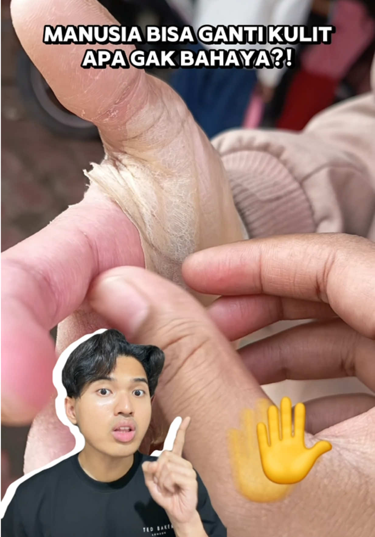 @Ekida