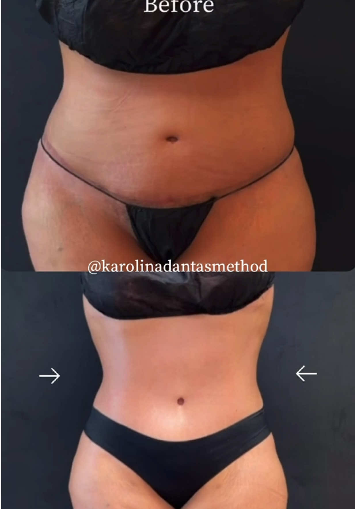 @KAROLINA DANTAS 🇧🇷