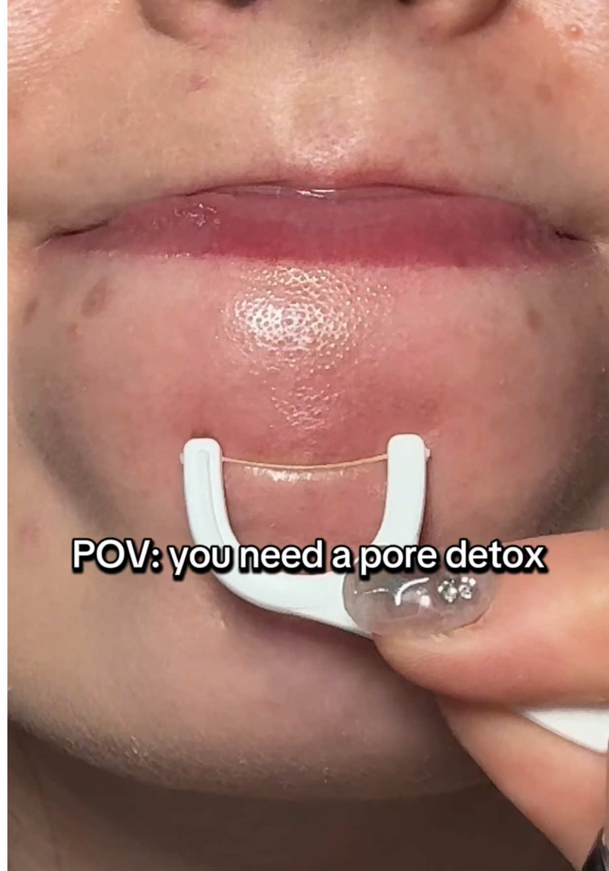 @watermelonsugarskin