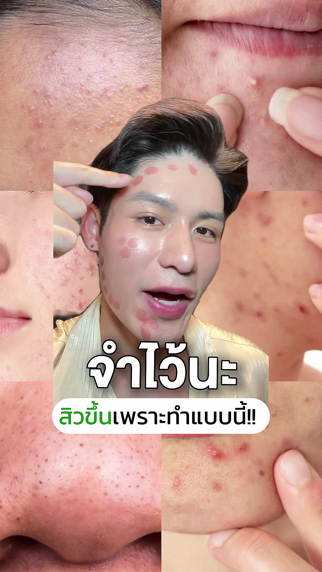 @หนูปอนด์ที่ชอบเลเซ่อร์
