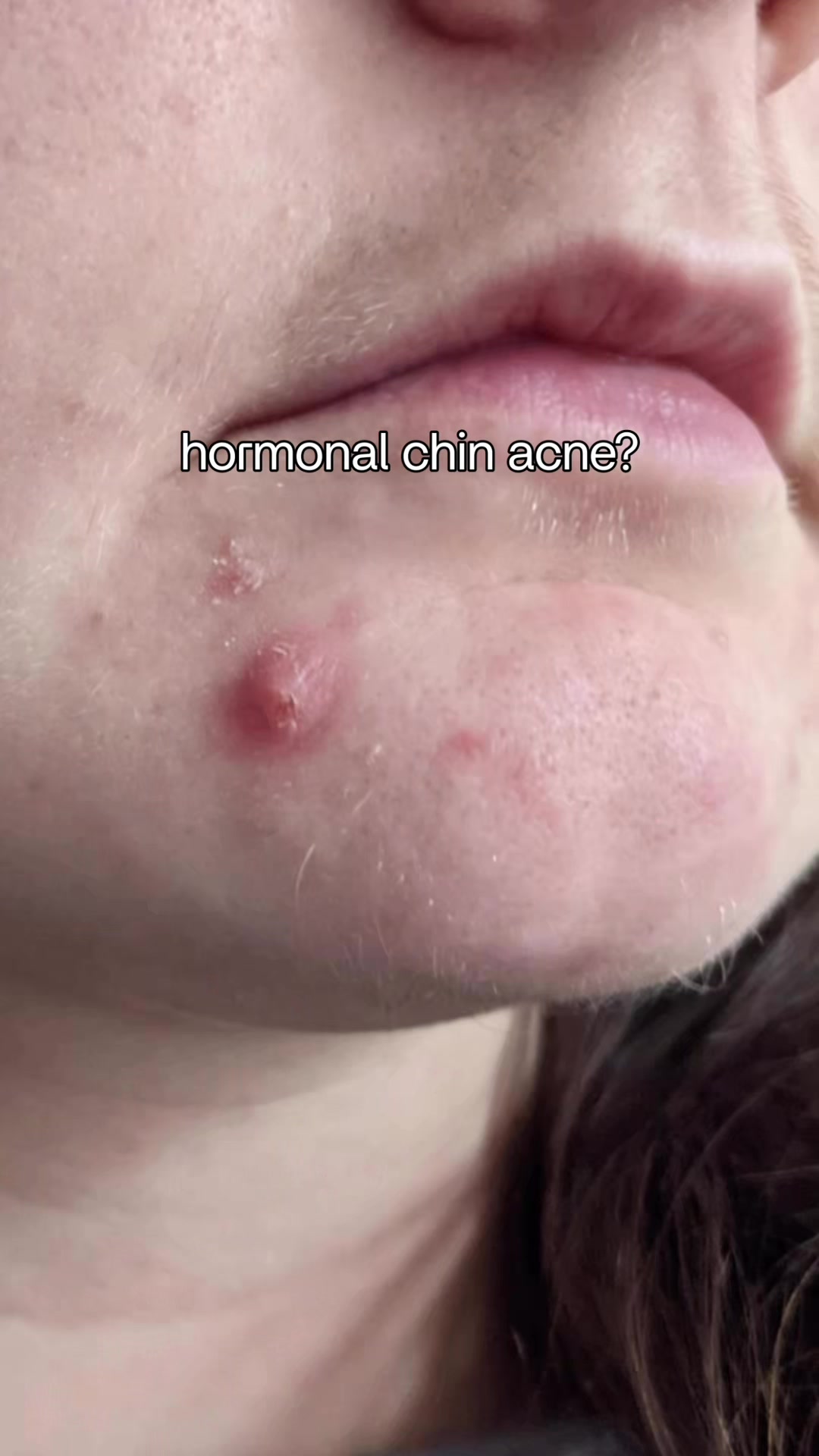 @Song Of Skin