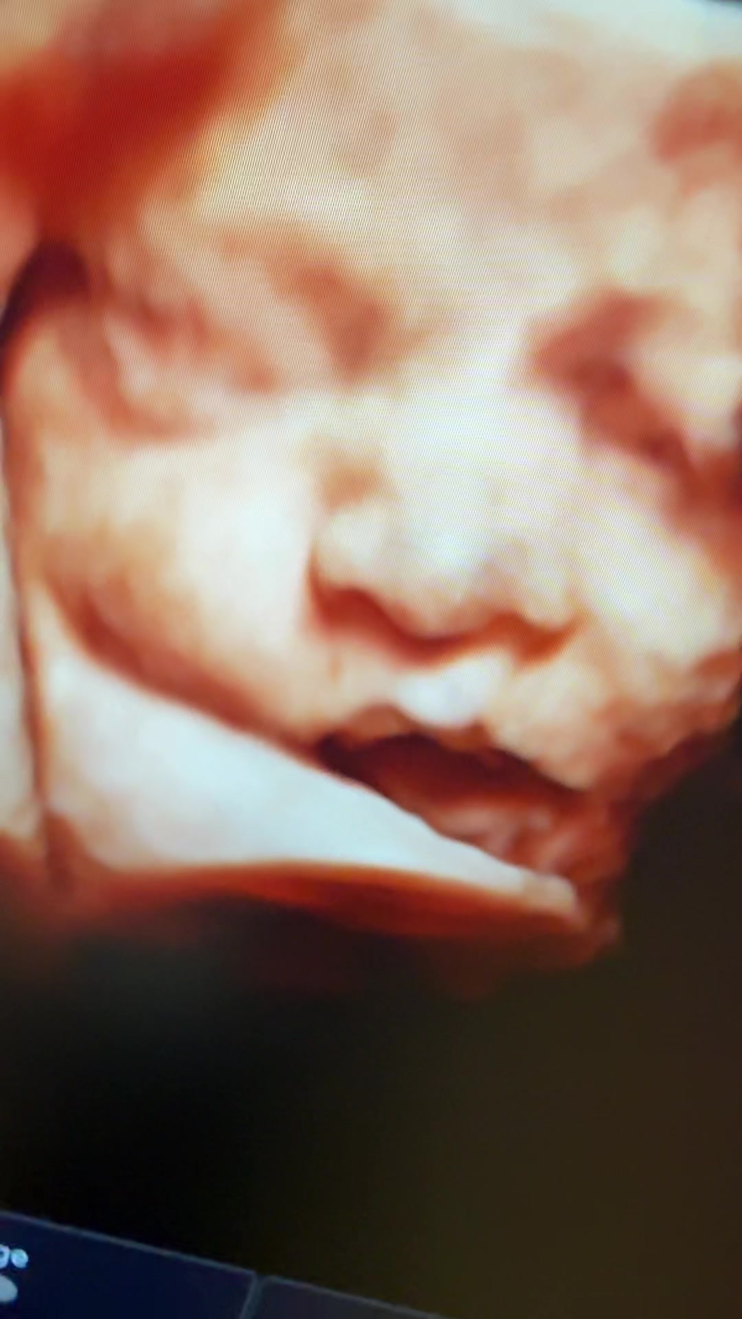 @PregnantSee Inc.