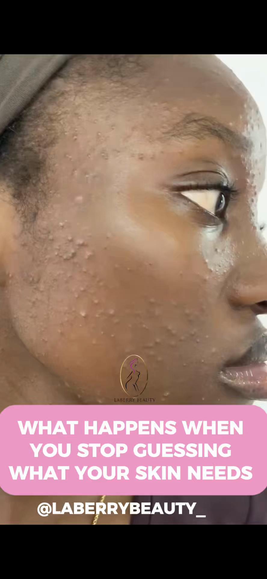 @LaBerry | Luxury Medspa Lagos