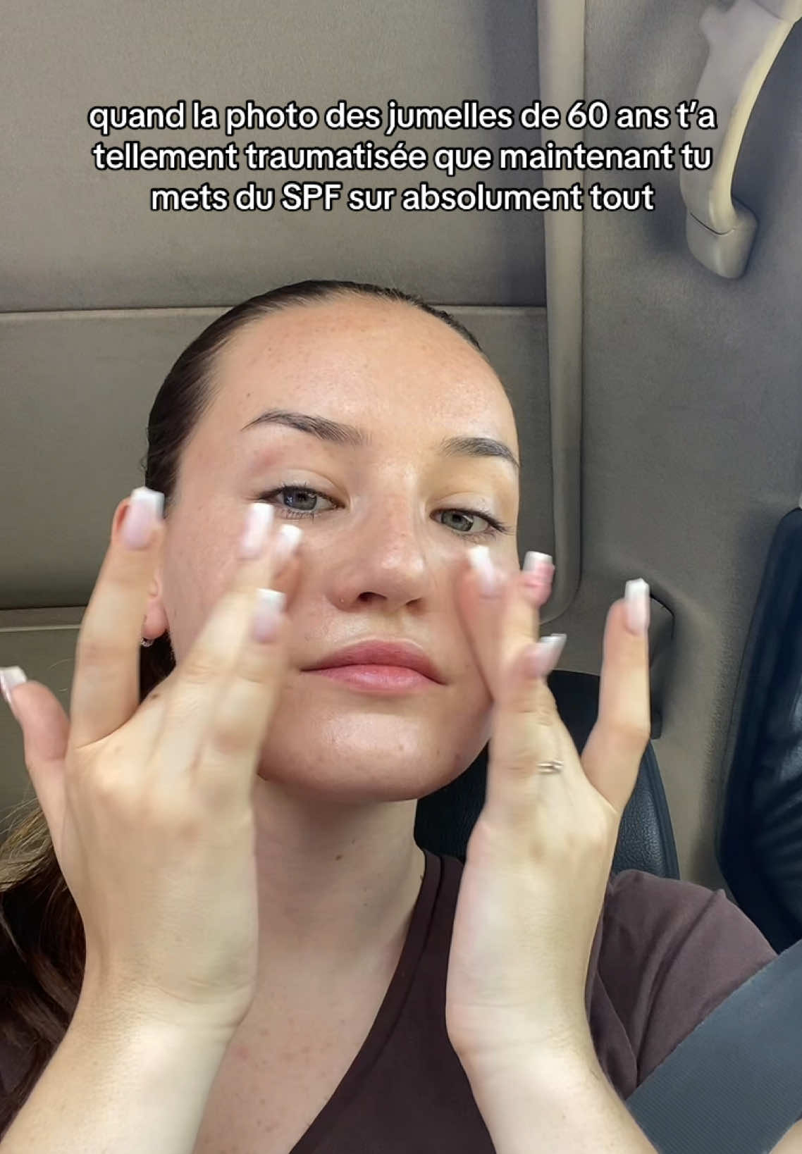 @applehead