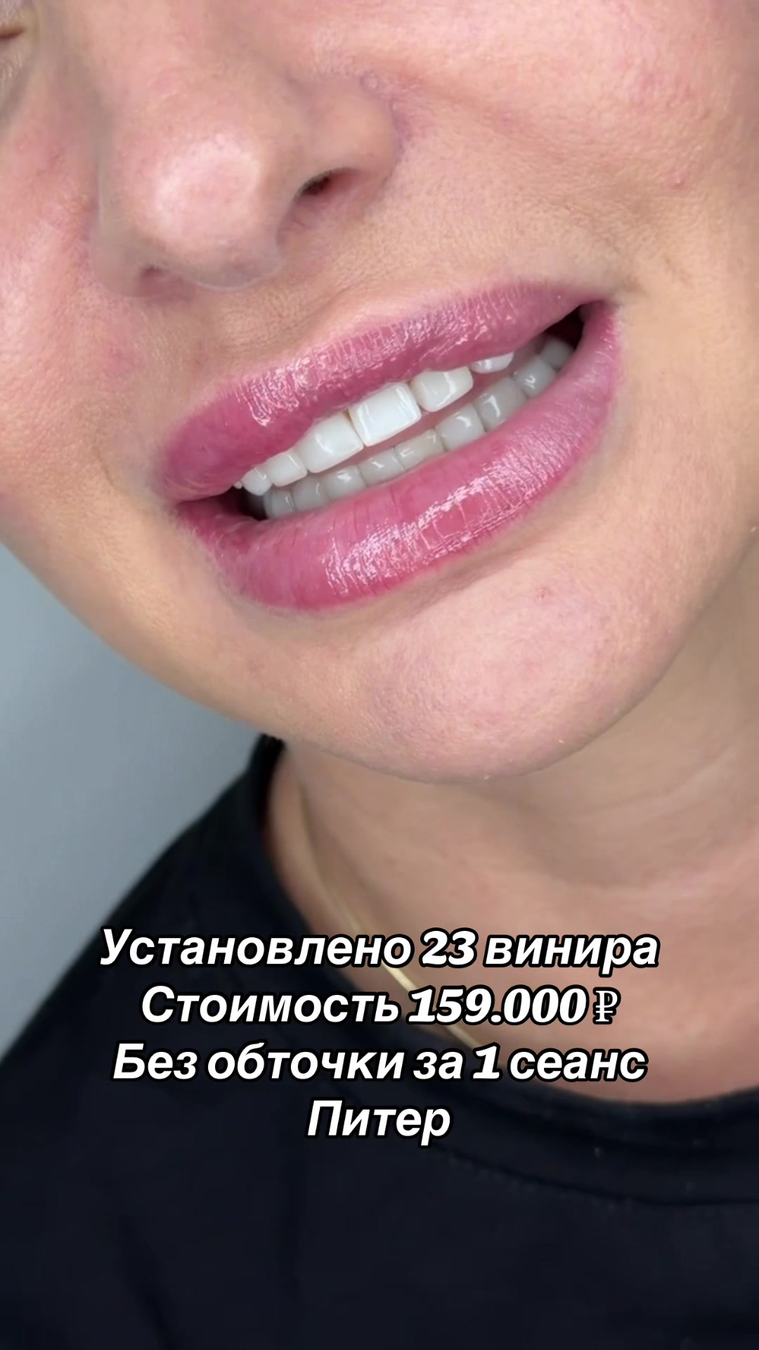 @Royal_smile_moscow