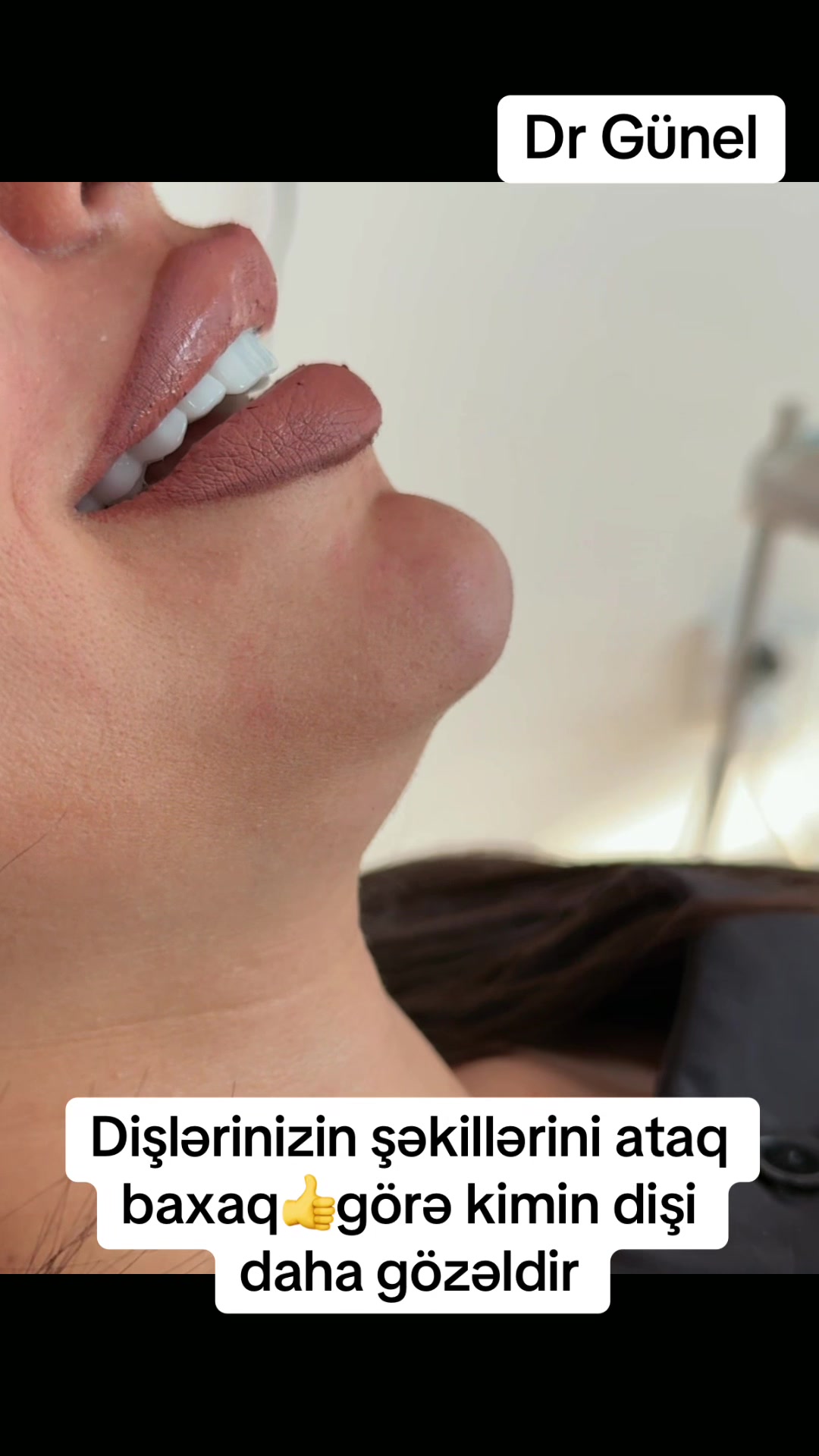 @Dentist_Günel