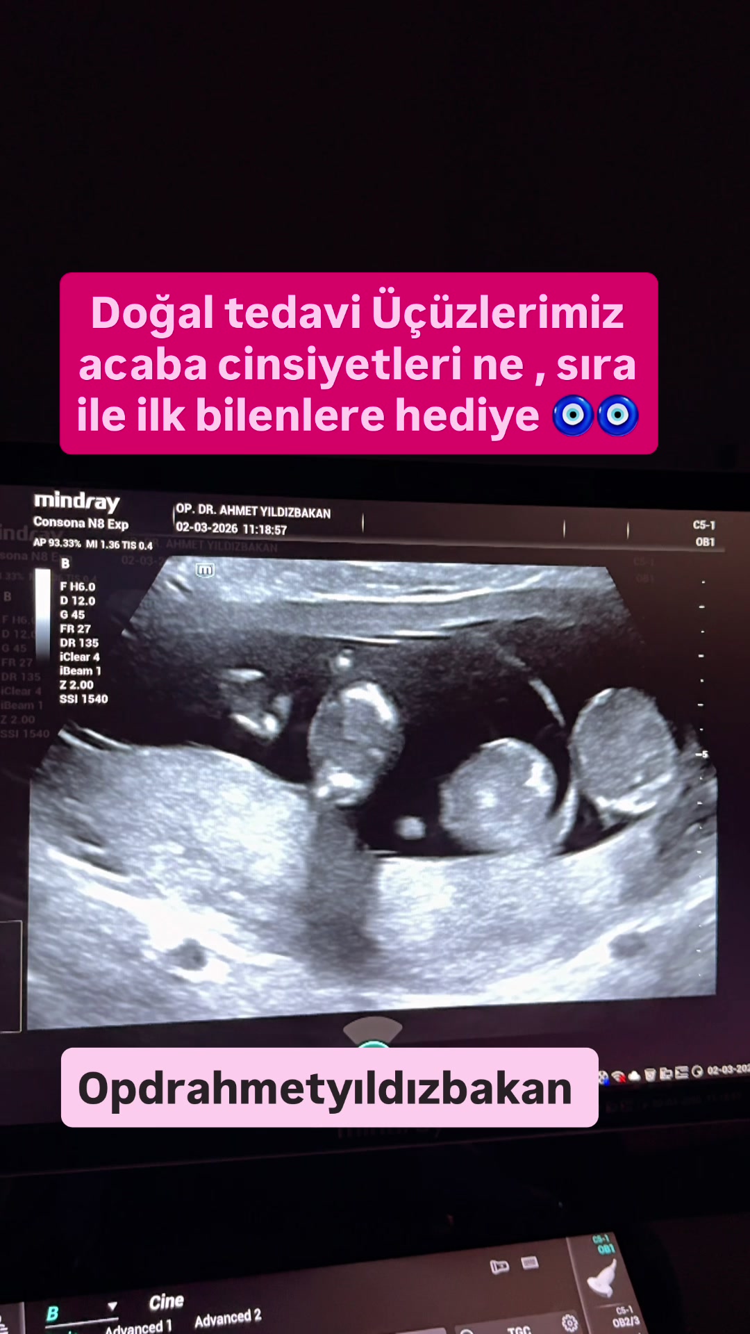 @opdrahmetyildizbakan