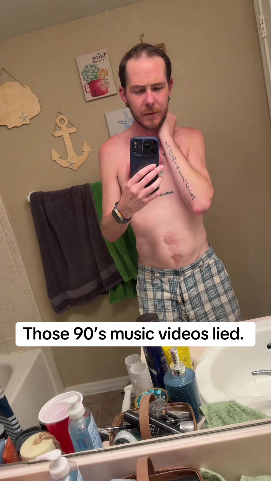 @Ryan