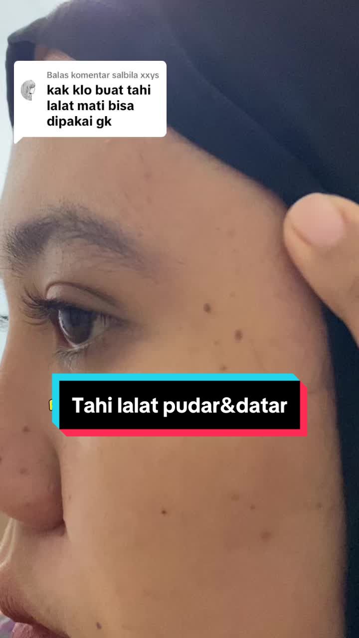 @Penghilangtahilalat.kaq.ay