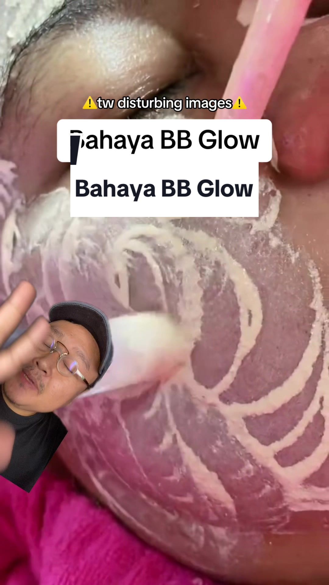 @Ali | @HungryForSkincare