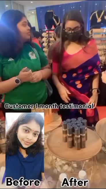 @Casing_viya
