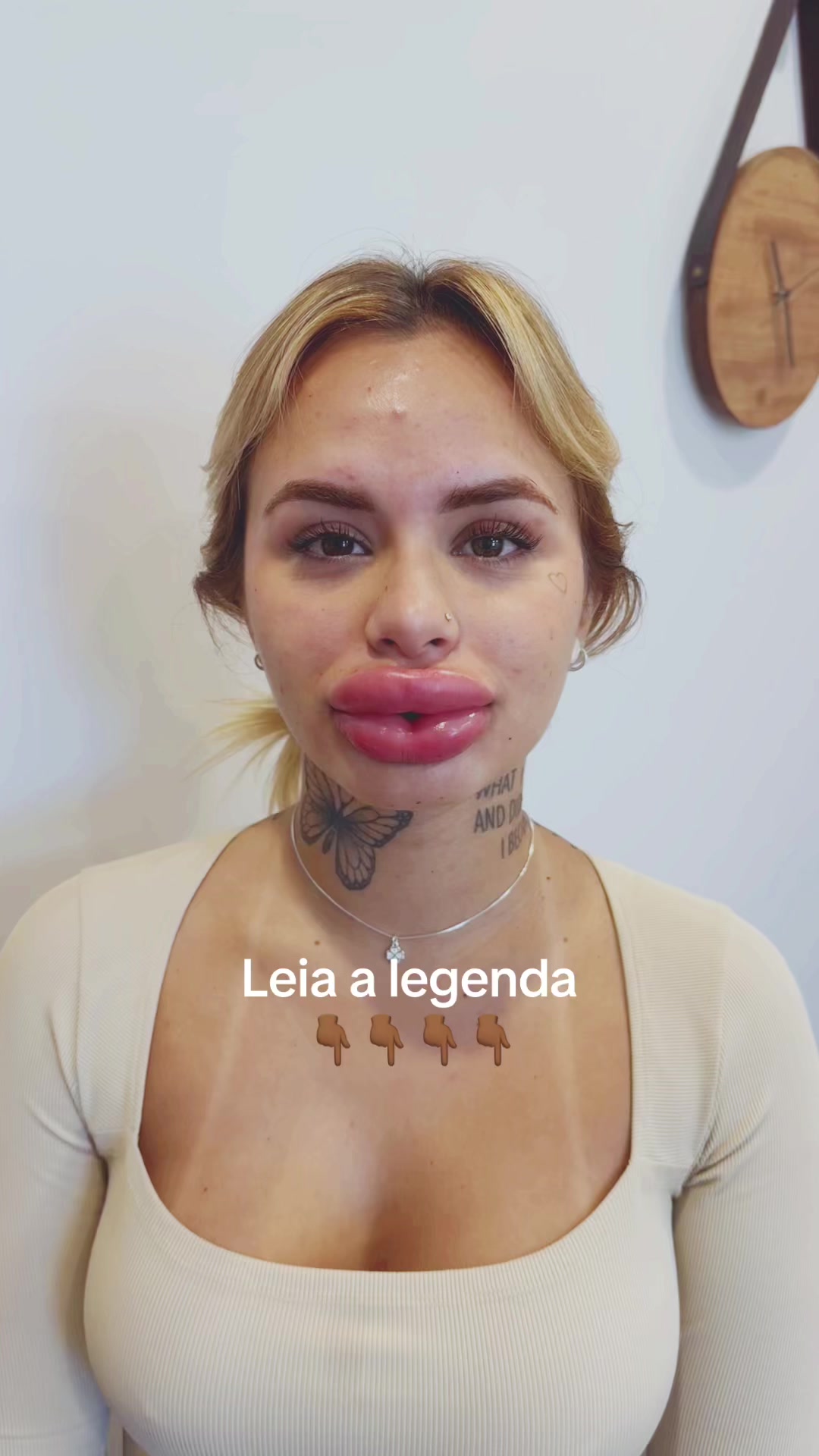 @Márcio Ferro