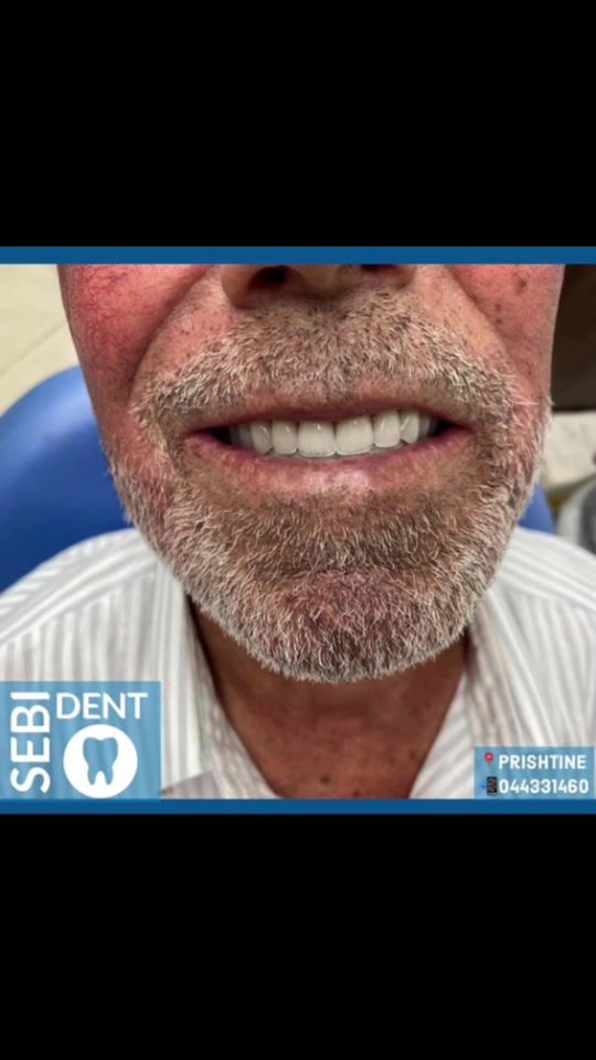 @sebi dent