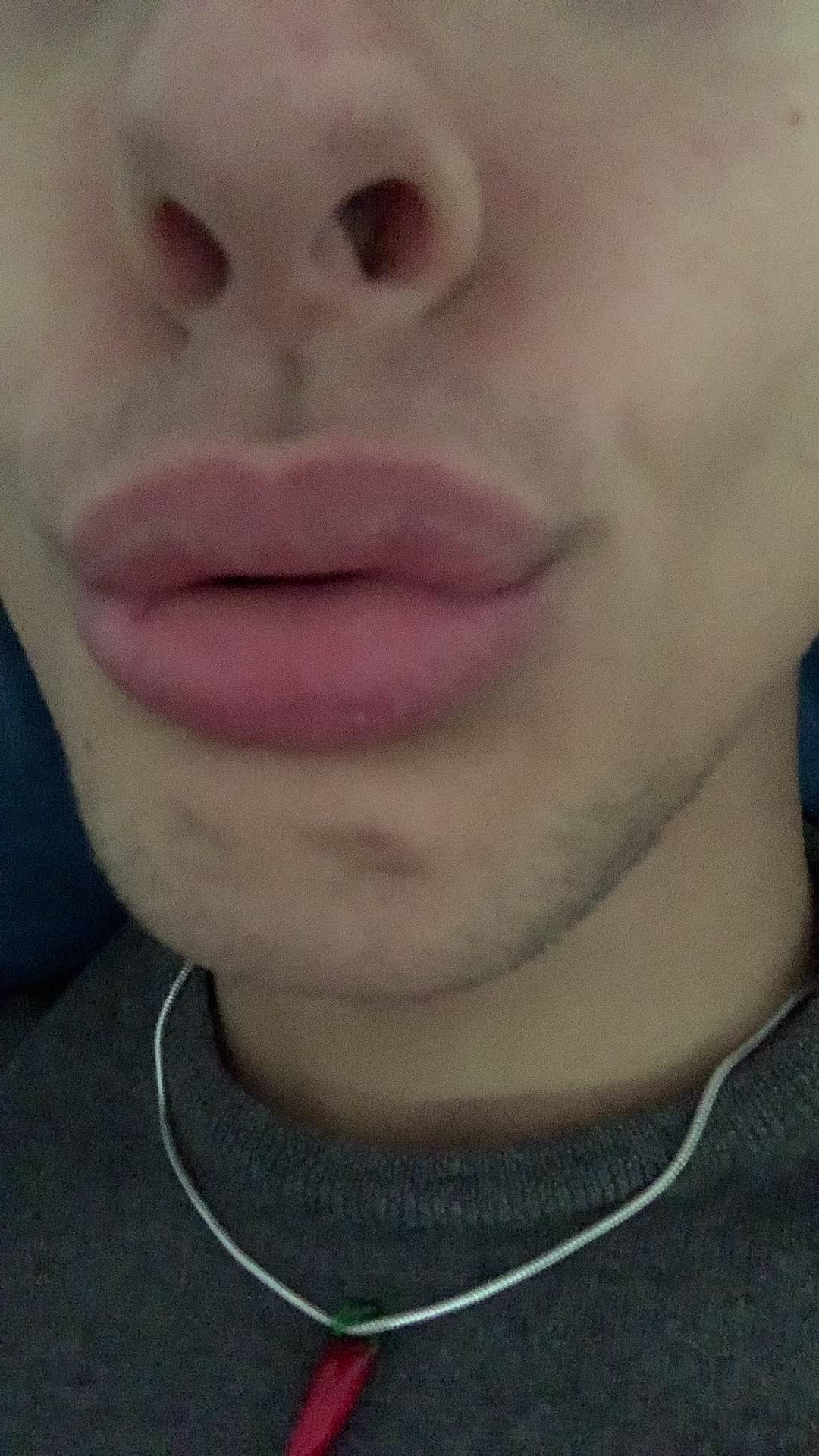 @Bozzediuncornuto2