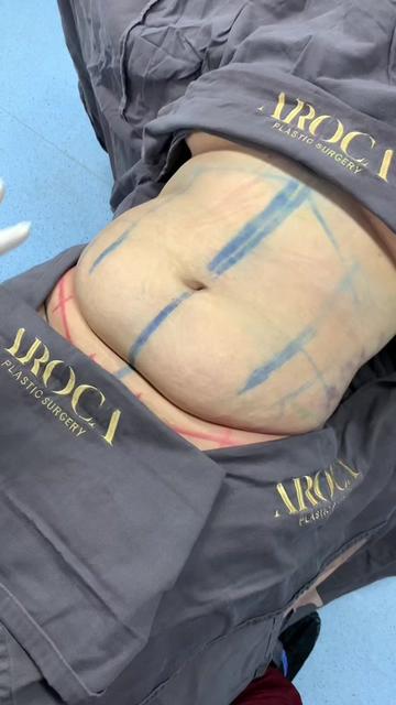 @Dr. Jaime Aroca