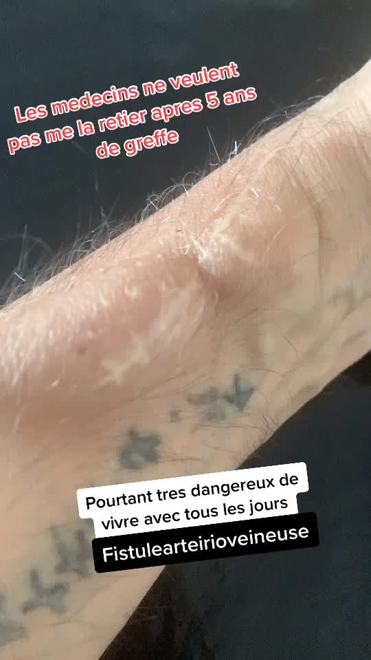 @phillou.2.0