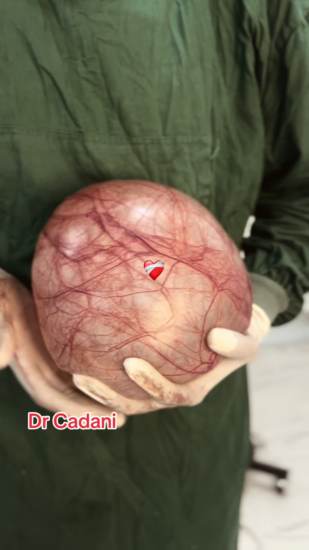 @Dr Cadani