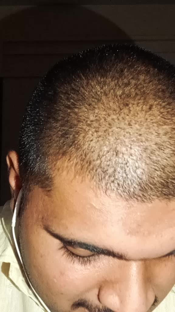 @आकाश हरगुङे