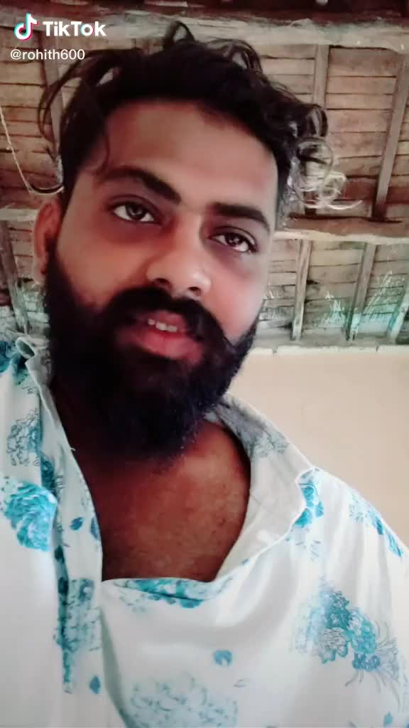 @Rakesh Nani 1436