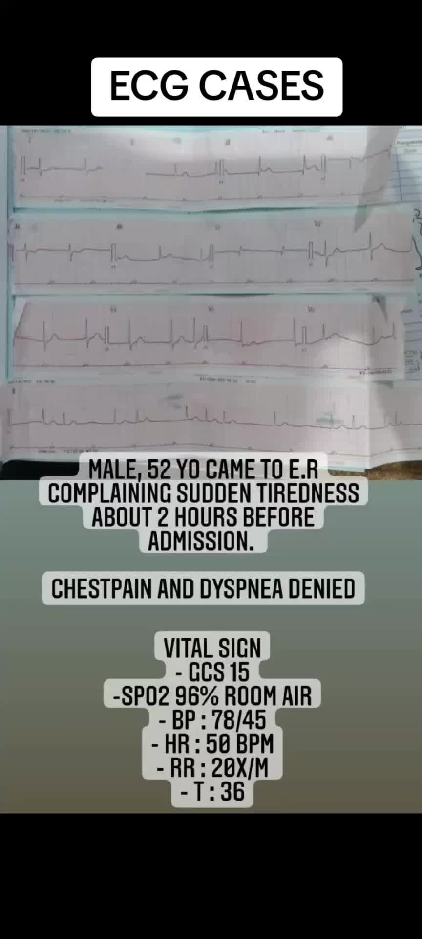 @Erlan A.P, MD